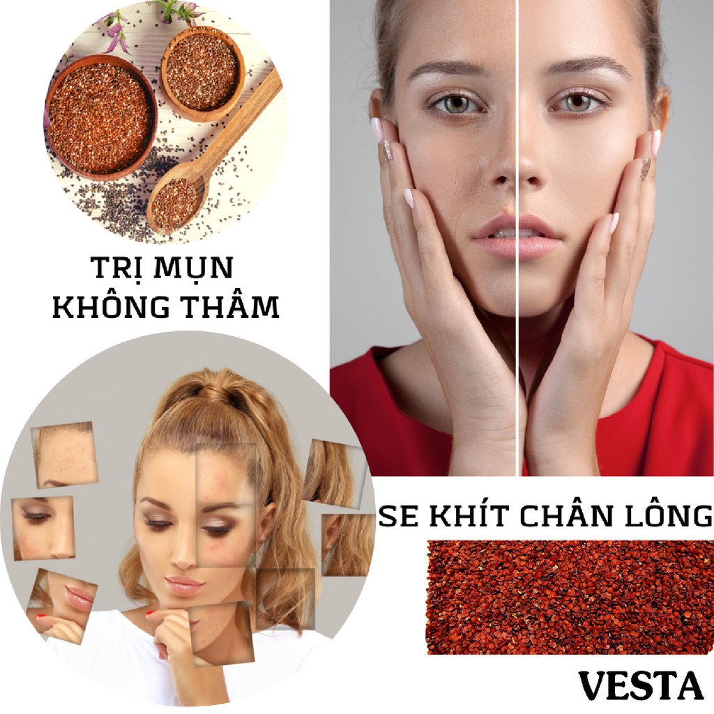 [Mã COS2405 giảm 8% đơn 300K] Mặt Nạ 𝑭𝒓𝒆𝒆𝒔𝒉𝒊𝒑 Mask Ngũ Hoa Rong Biển Nguyên Chất Vesta