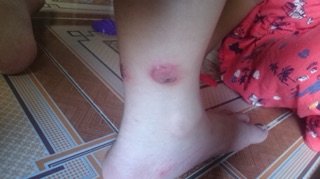 MỠ TRĂN NGUYÊN CHẤT N’STORE