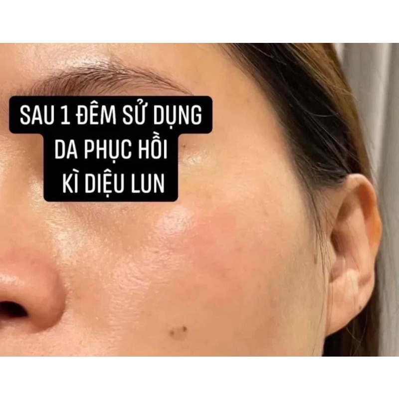 Kem dưỡng huyết tế bào Biomeek phục hồi dưỡng ẩm cho da