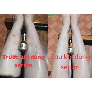 (Chính hãng) Combo 2 Hộp Serum Mờ Thâm Đa Năng PMT - Dưỡng Ẩm, Mờ Thâm Hiệu Quả, An Toàn | BigBuy360 - bigbuy360.vn