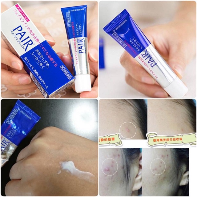Kem mụn Pair chấm mụn giảm mụn sưng viêm, mờ thâm Nhật Bản