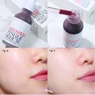 Tinh chất Red Peel Tingle Serum Sonatural