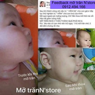 MỠ TRĂN NGUYÊN CHẤT N’STORE