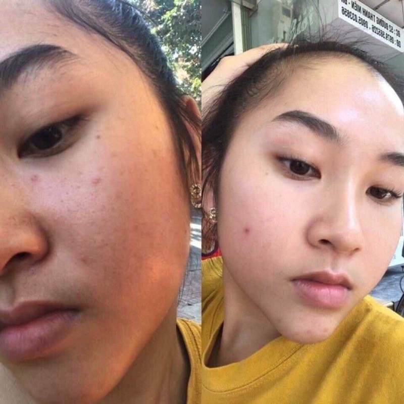 Detox Skin mẫu mới 2021 | BigBuy360 - bigbuy360.vn