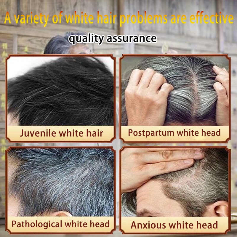 Tinh chất đen tóc Dầu dưỡng tóc ủ tóc phục hồi hư tổn serum dưỡng tóc dầu xả tóc Xịt tóc đen xịt mọc tóc 100ml | BigBuy360 - bigbuy360.vn