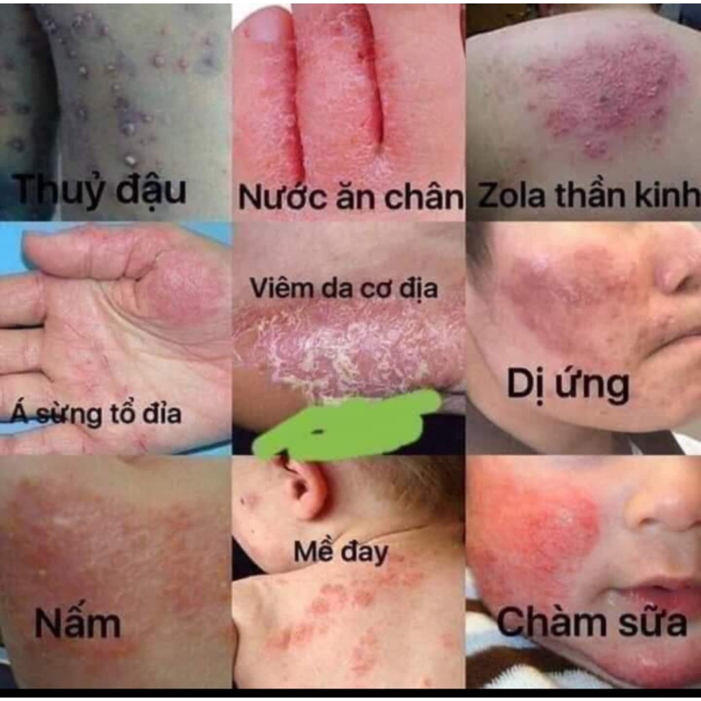 [Chính Hãng] Combo 2 tuýp kem bôi da Thuần 16gr Mộc