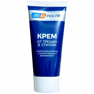 Kem Chống Nứt Nẻ Gót Chân Kpem Nga 50ml