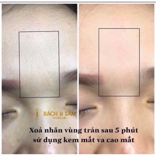Sét Mắt Bạch Linh - Bách Y Sâm