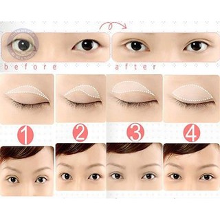 Kích Mí Dạng Lưới 120 Cặp