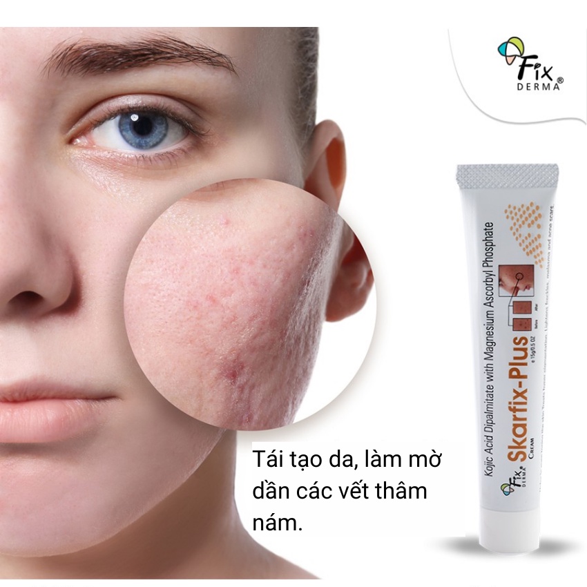 Kem Giảm Thâm Nám - Dưỡng Da Fixderma Skarfix Plus Cream 15g