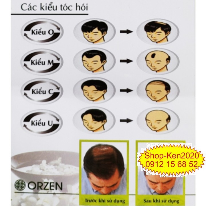 Dầu gội kích thích mọc tóc Orzen loss control shampoo 320ml