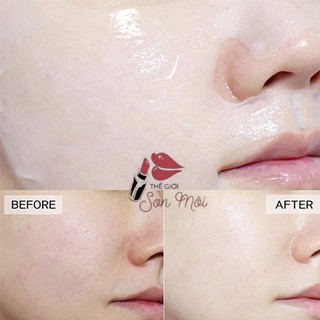 Miếng mặt nạ dưỡng da Mediheal Teatree