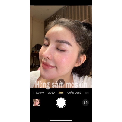 TÁI TẠO HỒNG SÂM MCSKIN