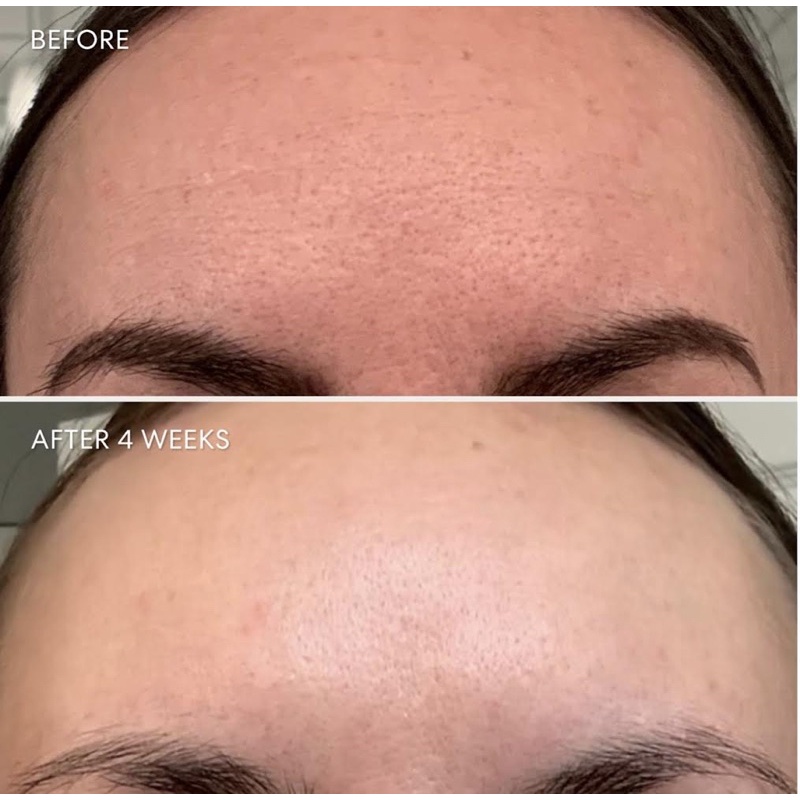 Tinh chất chống lão hoá Skinlongevity Long Life Herb Anti-Aging Face Serum 8ML