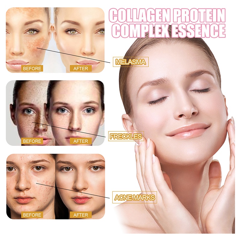 Serum Collagen Nhau Thai Cừu Chăm Sóc Da Hiệu Quả