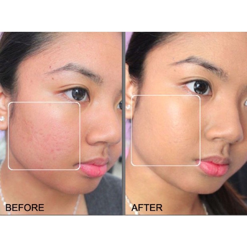 Kem nền cho da dầu mụn Neutrogena SkinClearing Oil-Free Makeup (30ml)