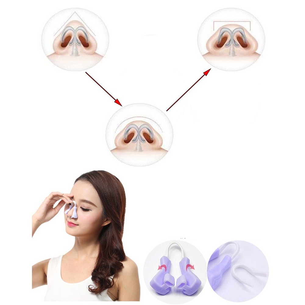 Kẹp hỗ trợ nâng làm thẳng mũi hiệu quả