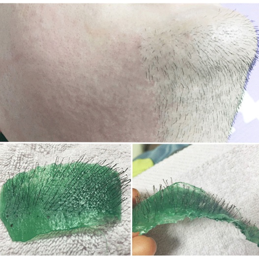 Sáp wax lông cao cấp dạng viên wax cực sạch, siêu bám lông triệt lông tận gốc