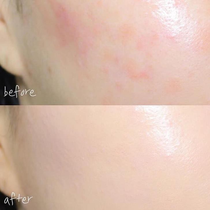 Serum cấp ẩm sâu SkiinCeuticals H.A Intensifier Minisize 4ml