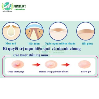 MIẾNG DÁN MỤN MAYAN CARE 0.8