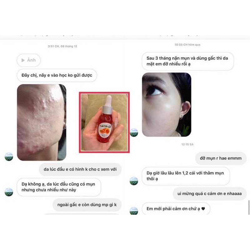 Tinh Dầu Gấc Tái Tạo Da | BigBuy360 - bigbuy360.vn