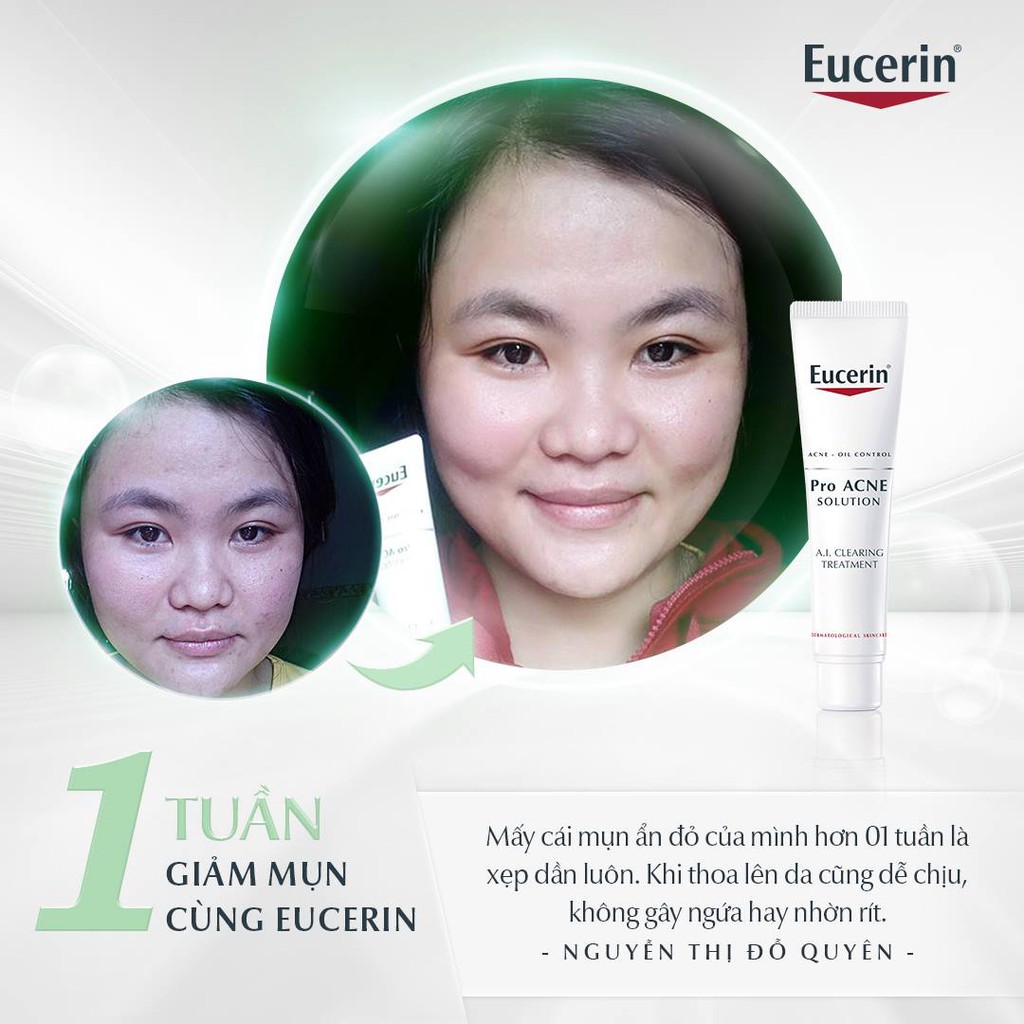 (CHÍNH HÃNG) Tinh Chất Eucerin Giảm Mụn Viêm, Mờ Vết Thâm 40ml Pro ACNE Solution A.I Clearing Treatment