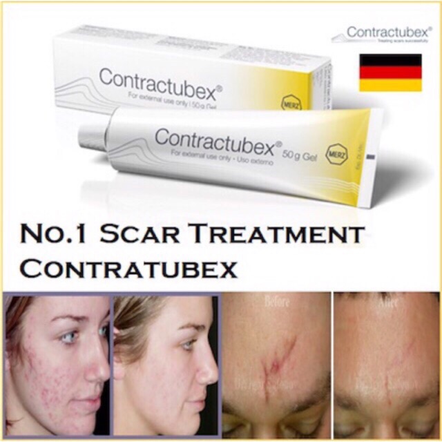 Gel ngừa sẹo- Contractubex