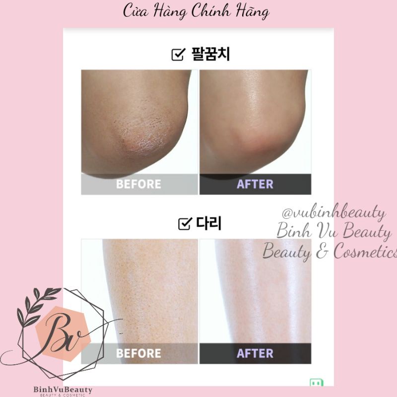 TẨY DA CHẾT CHO DA MỤN BODY DƯỠNG DA TRẮNG SÁNG PLU