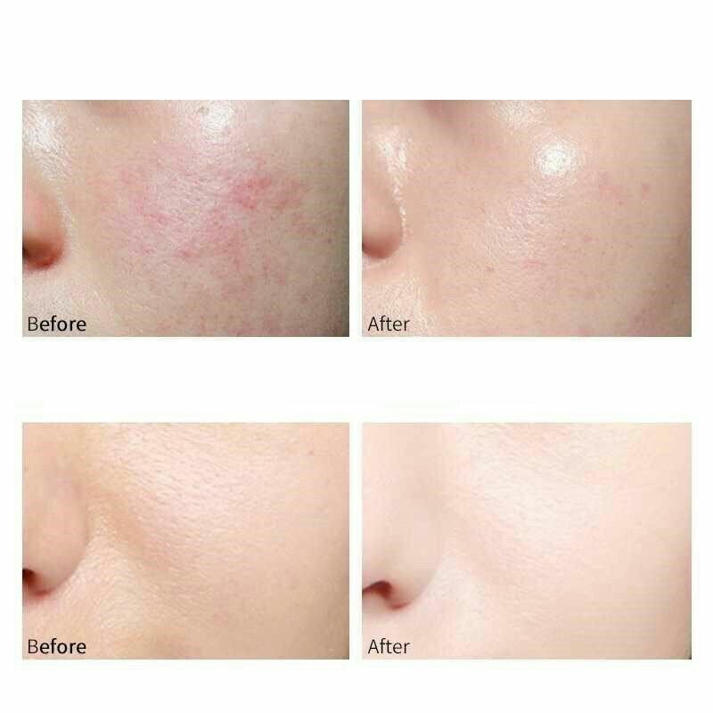 MẶT NẠ JOMTAM TRẮNG DA CẤP NƯỚC HYALURONIC ACID | BigBuy360 - bigbuy360.vn