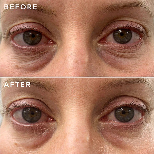 FARMACY 🌿 Kem Dưỡng Giảm Quầng Thâm Mắt Cheer Up Brightening Vitamin C Eye Cream with Acerola Cherry | BigBuy360 - bigbuy360.vn