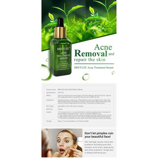 Serum Hỗ Trợ Giảm mụn BREYLEE 17ml
