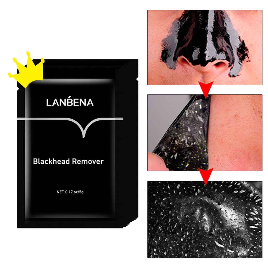 Mặt Nạ Hỗ Trợ Giảm Mụn Đầu Đen Làm Sạch Sâu Se Khít Lỗ Chân Lông Dành Cho Unisex