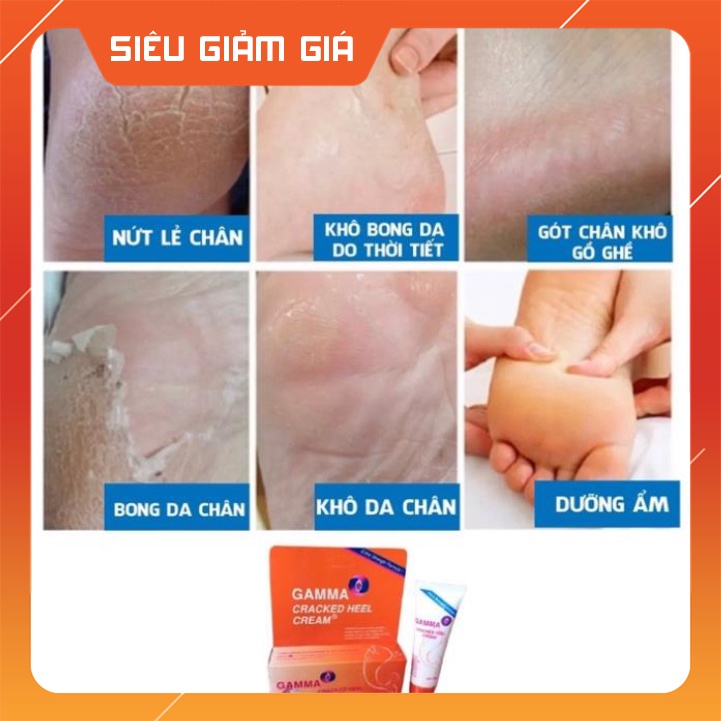 Kem giảm nứt gót chân, khô nứt da Gamma Cracked Heel sản phẩm chuyên dùng cho da khô nứt nẻ cho kết quả cực kỳ tốt. ...