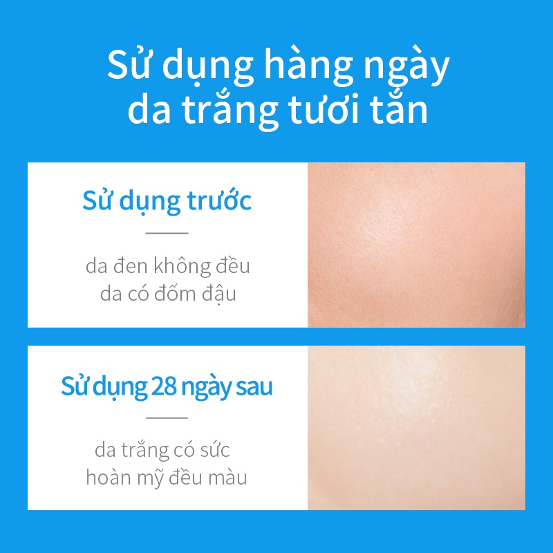 Tinh chất serum dưỡng WIS Niacinamide làm trắng và sáng da dưỡng ẩm phục hồi da