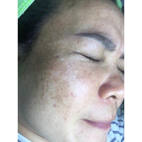 bộ kem đông y tái tạo da | BigBuy360 - bigbuy360.vn