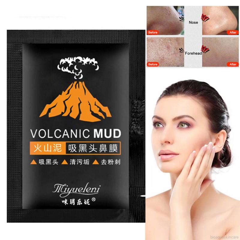 Mặt Nạ Lột Mụn Đầu Đen Dưỡng Ẩm Kiềm Dầu Thu Nhỏ Lỗ Chân Lông | BigBuy360 - bigbuy360.vn