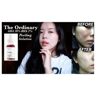 Serum The Ordinary AHA 30% + BHA 2% Peeling solution