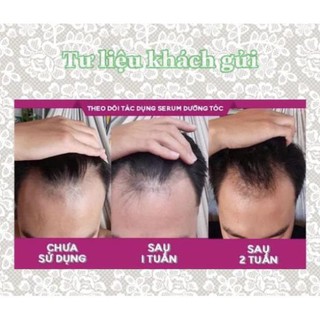 ♥️[Tặng Quà] LaGirl_Kích Thích Mọc Tóc♥️