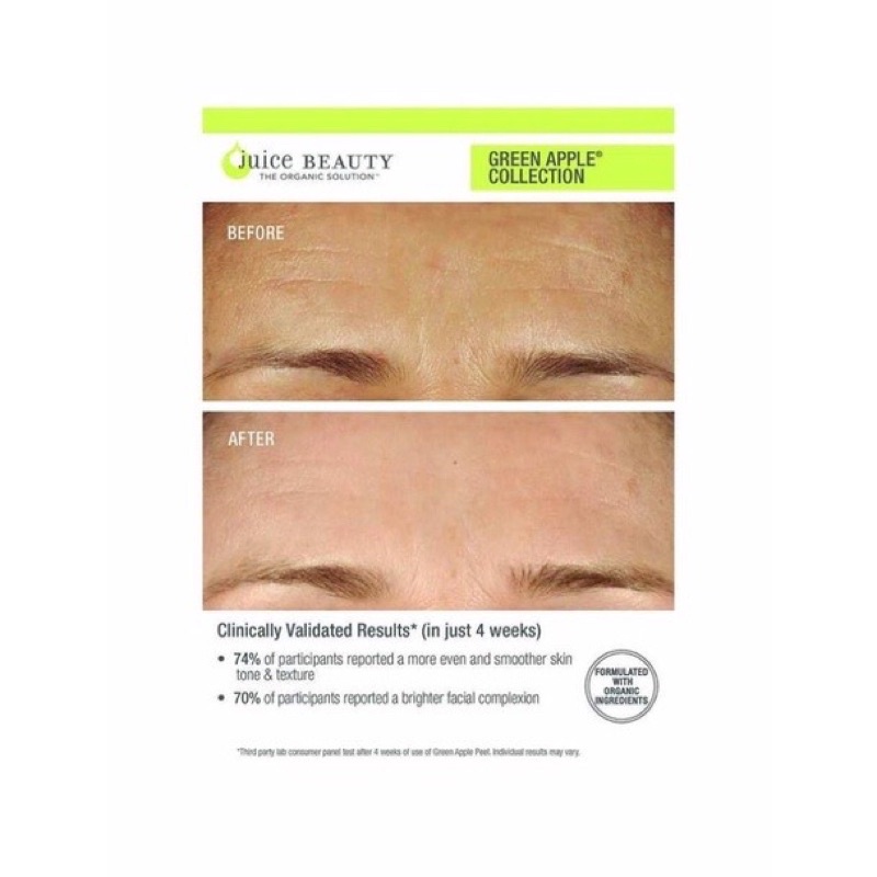 Mặt nạ tẩy da chết Juice Beauty GREEN APPLE PEEL FULL STRENGTH EXFOLIATING MASK