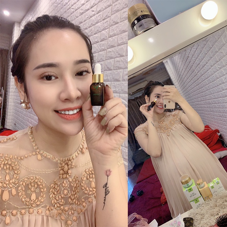 Serum mờ thâm nám tàn nhang trắng da, mỹ phẩm cho bà bầu V9Queen an toàn hiệu quả