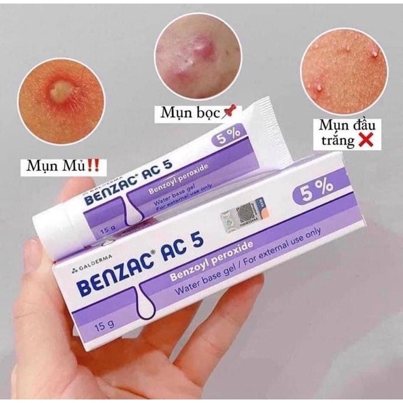 Gel chấm mụn Benzac ac 5 15g