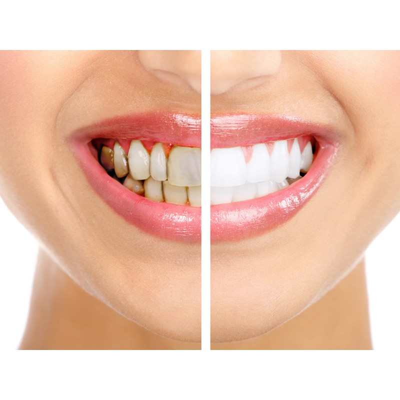 Than hoạt tính  - NHẬT BẢN- 10g - 20g