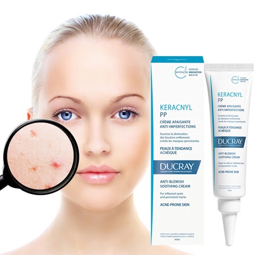 Kem dưỡng Ducray Keracnyl PP Anti-Blemish Soothing Cream 30ml giúp làm giảm mụn, mờ vết thâm