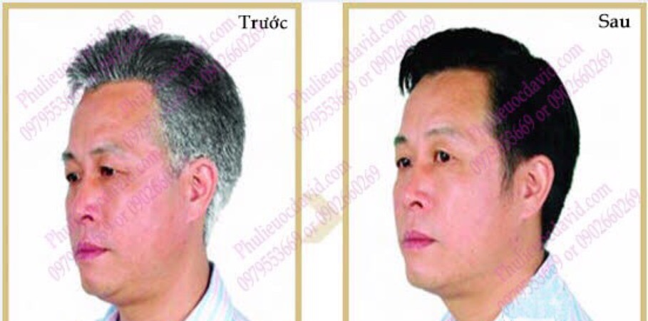 1 hộp 10 gối Dầu gội YoSaTen | BigBuy360 - bigbuy360.vn