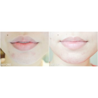 Serum cấp nước 9wishes HYDRA SKIN AMPULE SERUM