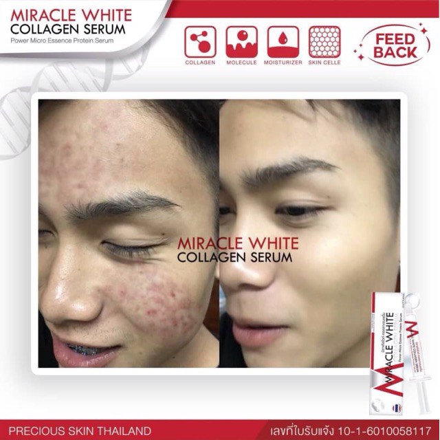 SERUM DƯỠNG DA VÀ GIẢM THÂM NÁM MIRACLE WHITE COLLAGEN 10ml