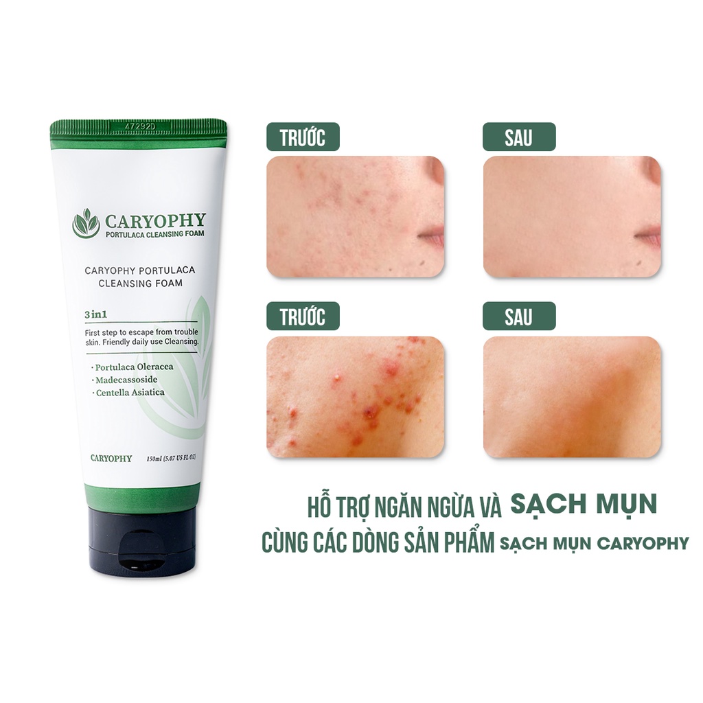 Sữa rửa mặt cho bà bầu cho da dầu mụn da khô da nhạy cảm Hàn Quốc chính hãng Caryophy 150ml