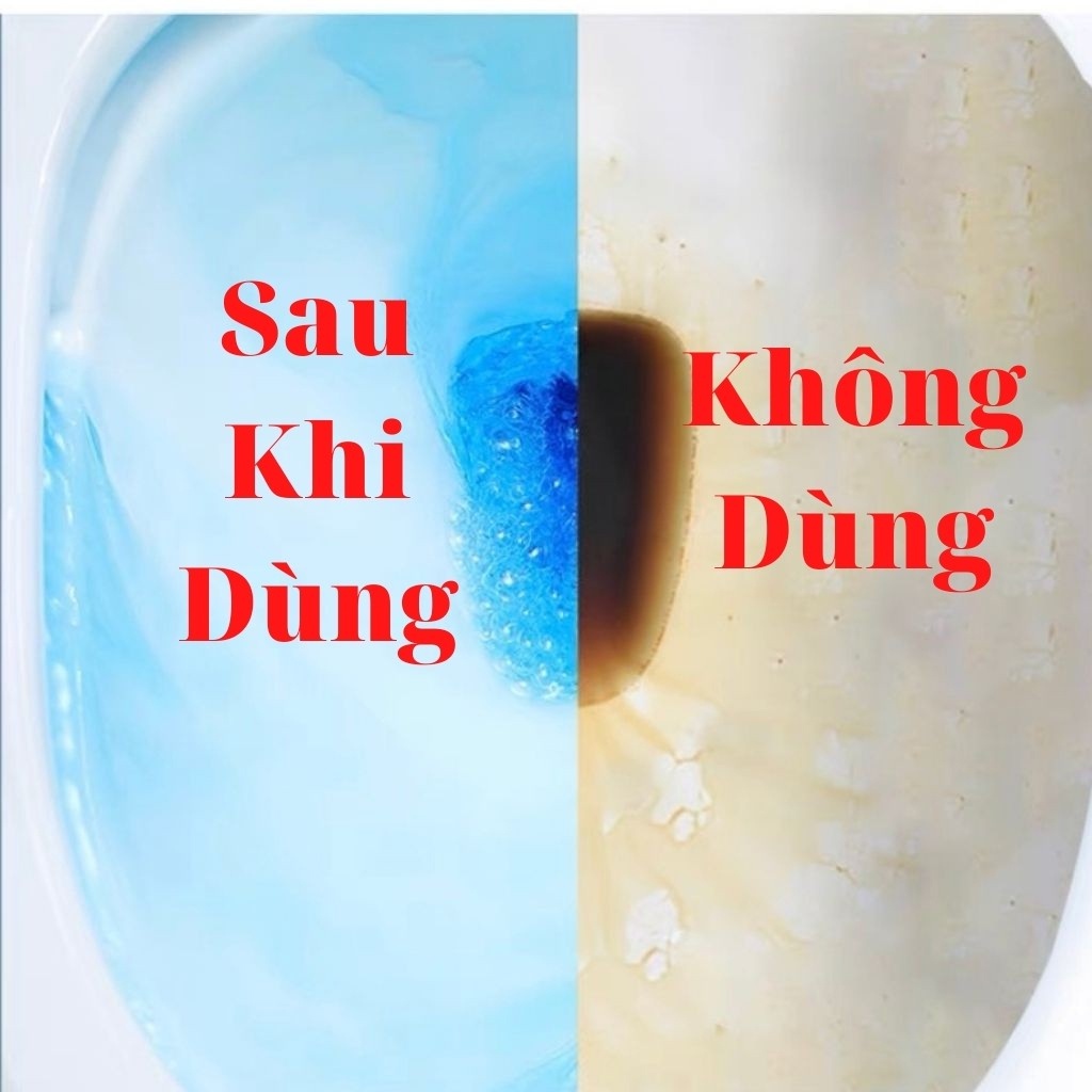 Thả Bồn Cầu, Lọ Thả Bồn Khử Mùi Hanvit Diệt Khuẩn, Hương Hoa Hàn Quốc Chung Blue 180gr