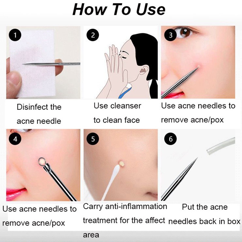 Nhíp diệt mụn đầu đen Lewedo bằng thép không gỉ tiện lợi