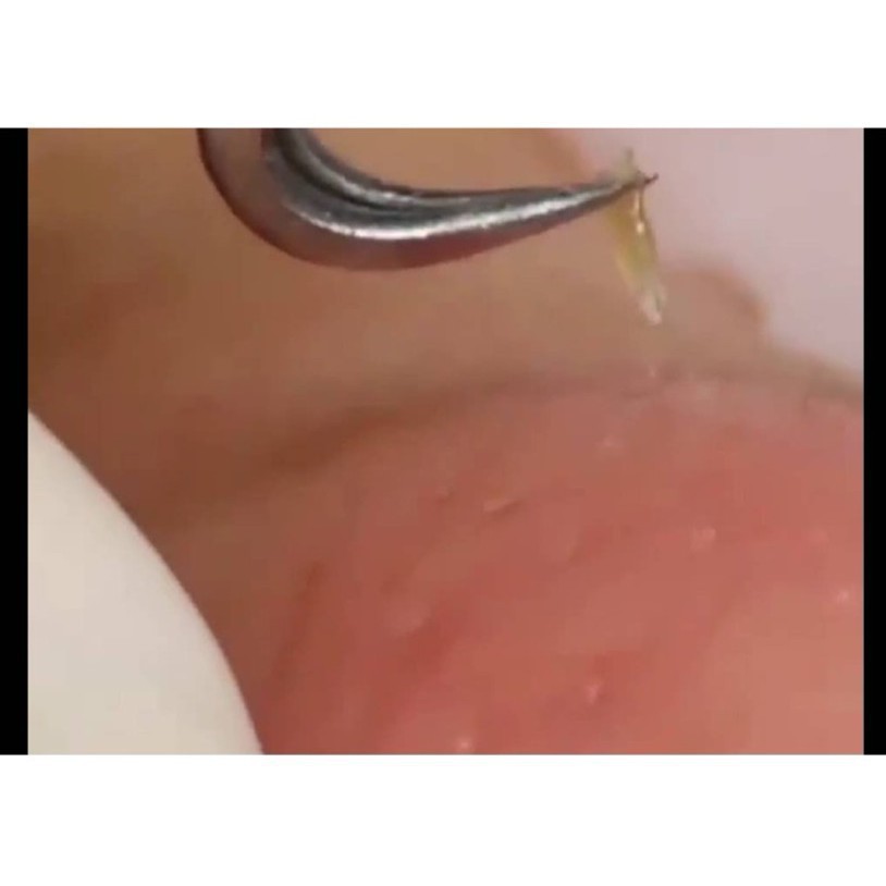 Nhíp gắp mụn GM01 đầu cong 00798567 GIAO HANG SIEU TOC88